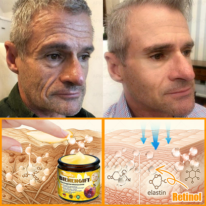 Hergestellt in Deutschland ✨APKAPK® Bienengift Hautregenerations creme – Anti-Aging, Feuchtigkeitsspendend, Hautreparatur, Hautbildverbesserung, Akne- und Pigmentfleckenbehandlung, Warzen- und Muttermalentfernung, Linderung bei Psoriasis