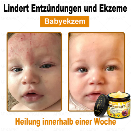 Hergestellt in Deutschland ✨APKAPK® Bienengift Hautregenerations creme – Anti-Aging, Feuchtigkeitsspendend, Hautreparatur, Hautbildverbesserung, Akne- und Pigmentfleckenbehandlung, Warzen- und Muttermalentfernung, Linderung bei Psoriasis
