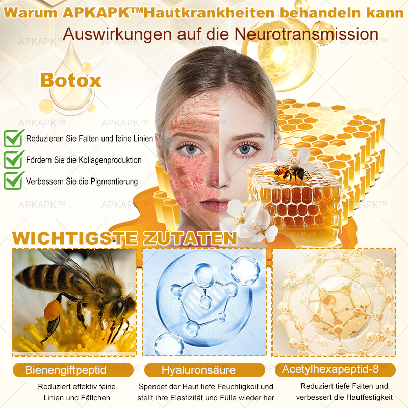 Hergestellt in Deutschland ✨APKAPK® Bienengift Hautregenerations creme – Anti-Aging, Feuchtigkeitsspendend, Hautreparatur, Hautbildverbesserung, Akne- und Pigmentfleckenbehandlung, Warzen- und Muttermalentfernung, Linderung bei Psoriasis
