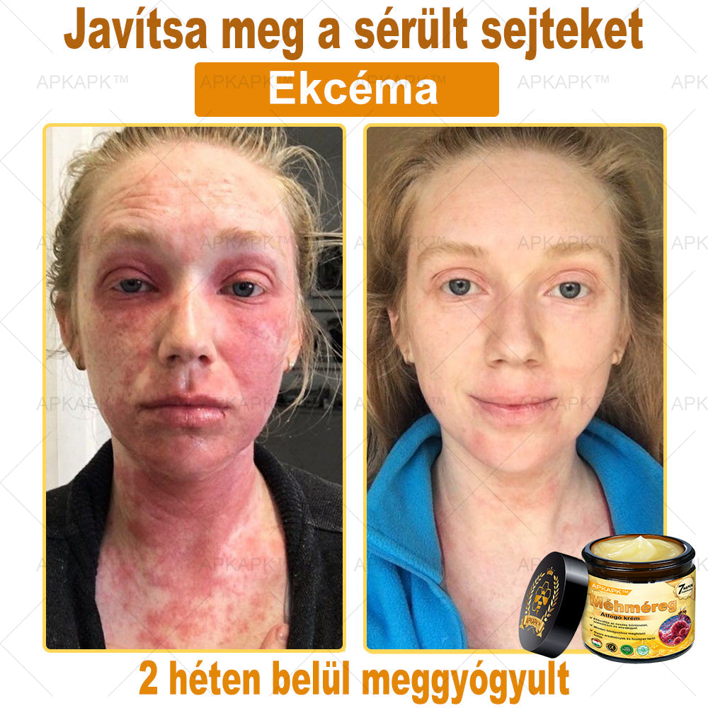 🎁 🎁Zostało tylko 5 sztuk! Oferujemy dodatkową zniżkę 50%! Zdobądź formę i zdrowie. Nie czekaj, stracisz okazję, aż do przyszłego roku