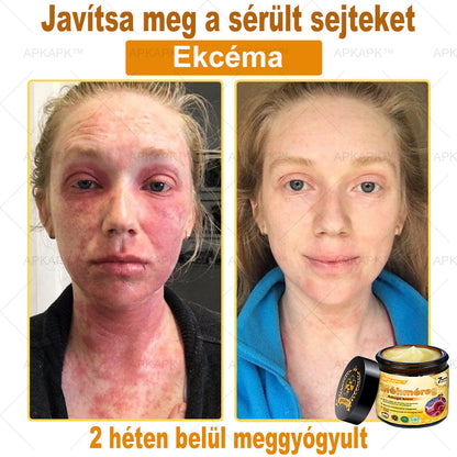 🎁 🎁Zostało tylko 5 sztuk! Oferujemy dodatkową zniżkę 50%! Zdobądź formę i zdrowie. Nie czekaj, stracisz okazję, aż do przyszłego roku