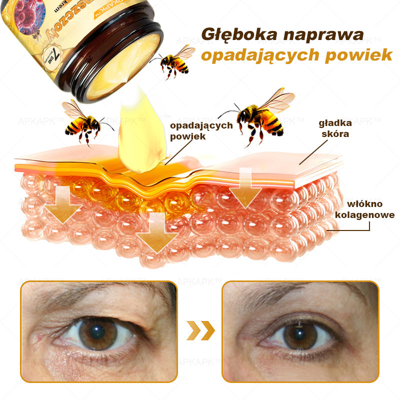 ΑPΚΑPK™ Jad Pszczoły Kompleksowy Krem🥇🥇pomaga w leczeniu problemów skórnych, takich jak: zmarszczki, blizny, plamy pigmentacyjne, rozstępy, trądzik, łuszczyca, egzema, zmiany skórne, podrażnienia, stany zapalne i inne problemy skórne🔥