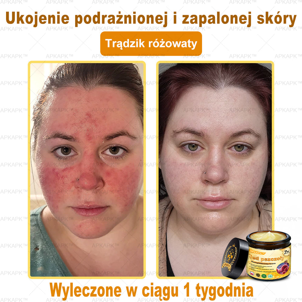 🎁 🎁Zostało tylko 5 sztuk! Oferujemy dodatkową zniżkę 50%! Zdobądź formę i zdrowie. Nie czekaj, stracisz okazję, aż do przyszłego roku