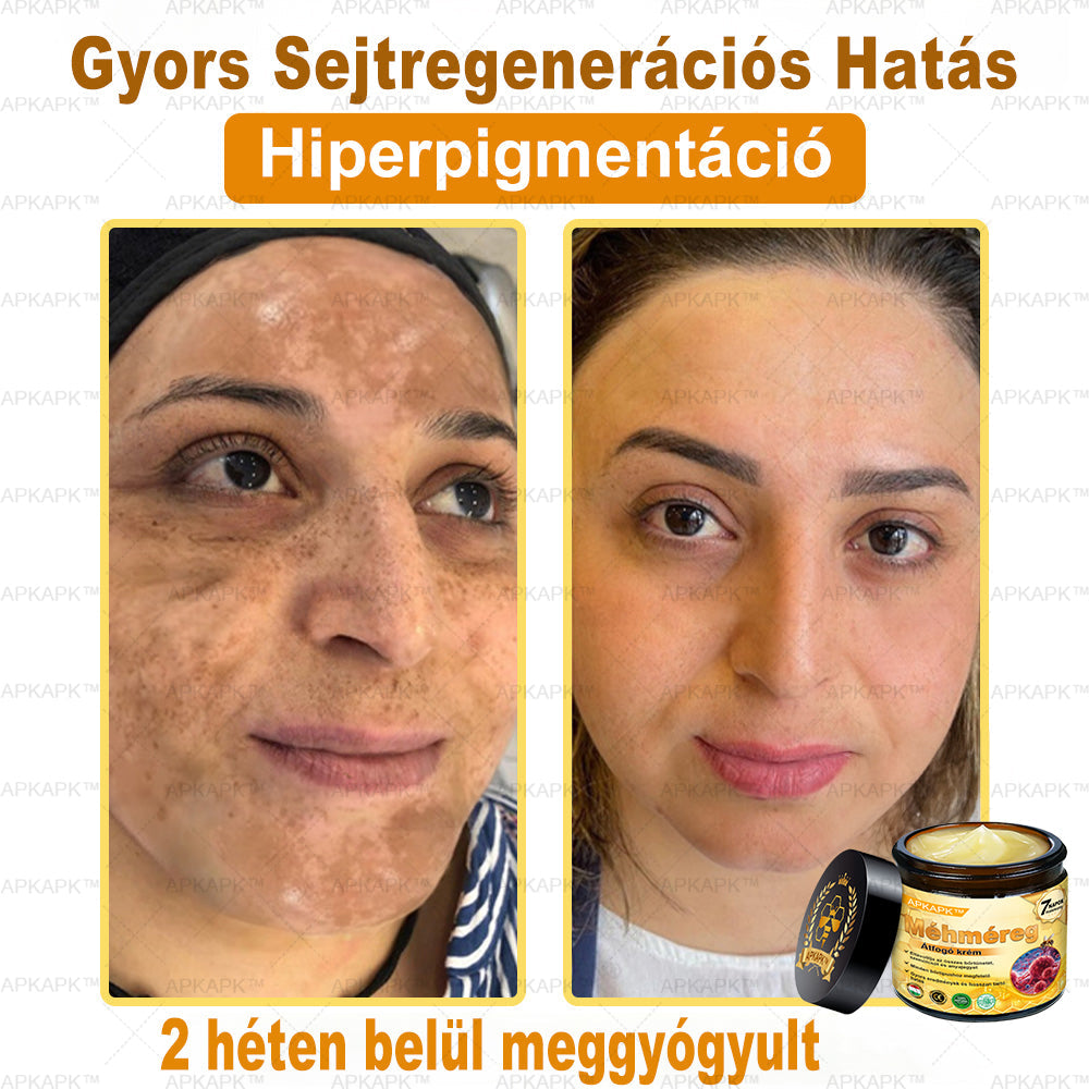 🎁 🎁Zostało tylko 5 sztuk! Oferujemy dodatkową zniżkę 50%! Zdobądź formę i zdrowie. Nie czekaj, stracisz okazję, aż do przyszłego roku