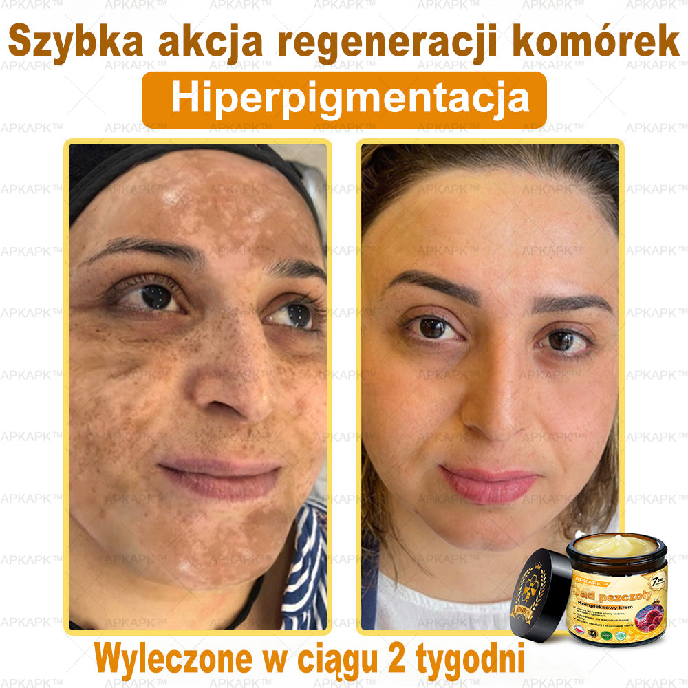 🎁 🎁Zostało tylko 5 sztuk! Oferujemy dodatkową zniżkę 50%! Zdobądź formę i zdrowie. Nie czekaj, stracisz okazję, aż do przyszłego roku