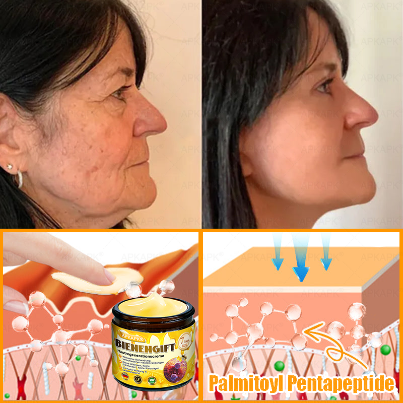 Hergestellt in Deutschland ✨APKAPK® Bienengift Hautregenerations creme – Anti-Aging, Feuchtigkeitsspendend, Hautreparatur, Hautbildverbesserung, Akne- und Pigmentfleckenbehandlung, Warzen- und Muttermalentfernung, Linderung bei Psoriasis