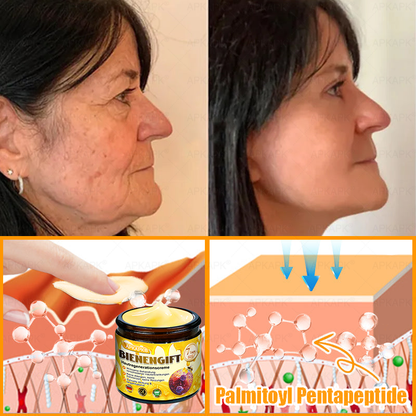 Hergestellt in Deutschland ✨APKAPK® Bienengift Hautregenerations creme – Anti-Aging, Feuchtigkeitsspendend, Hautreparatur, Hautbildverbesserung, Akne- und Pigmentfleckenbehandlung, Warzen- und Muttermalentfernung, Linderung bei Psoriasis