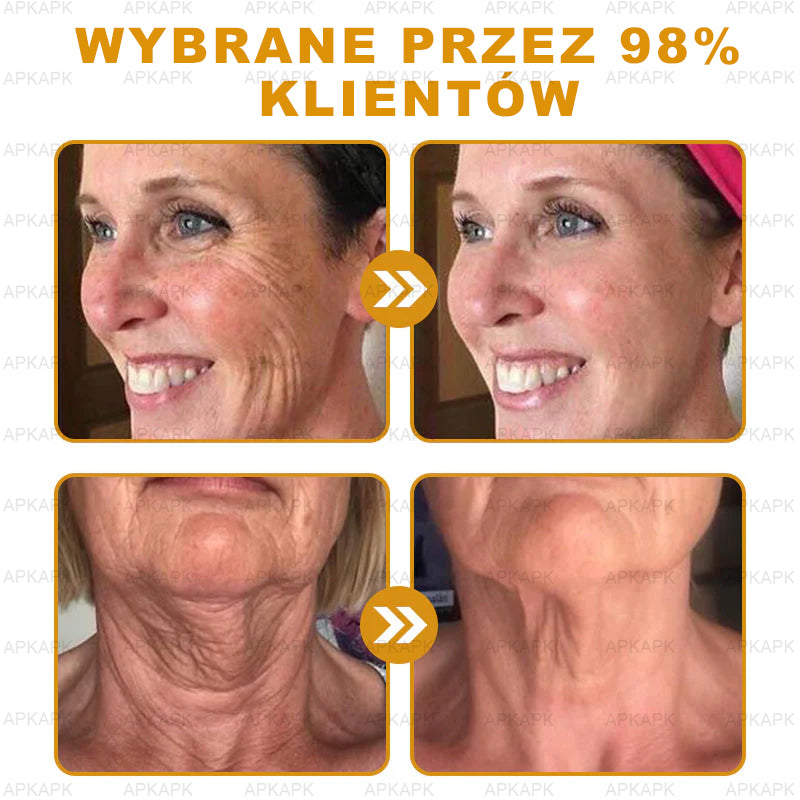 ΑPΚΑPK™ Jad Pszczoły Kompleksowy Krem🥇🥇pomaga w leczeniu problemów skórnych, takich jak: zmarszczki, blizny, plamy pigmentacyjne, rozstępy, trądzik, łuszczyca, egzema, zmiany skórne, podrażnienia, stany zapalne i inne problemy skórne🔥