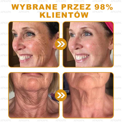 ΑPΚΑPK™ Jad Pszczoły Kompleksowy Krem🥇🥇pomaga w leczeniu problemów skórnych, takich jak: zmarszczki, blizny, plamy pigmentacyjne, rozstępy, trądzik, łuszczyca, egzema, zmiany skórne, podrażnienia, stany zapalne i inne problemy skórne🔥