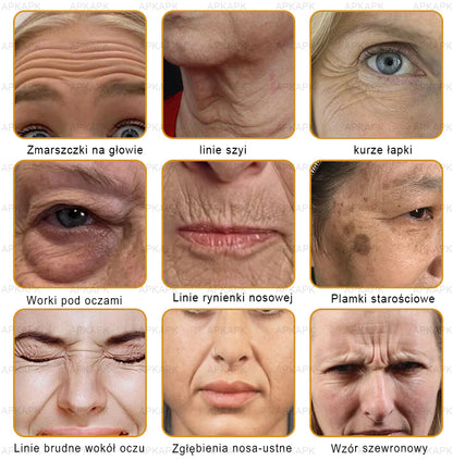 ΑPΚΑPK™ Jad Pszczoły Kompleksowy Krem🥇🥇pomaga w leczeniu problemów skórnych, takich jak: zmarszczki, blizny, plamy pigmentacyjne, rozstępy, trądzik, łuszczyca, egzema, zmiany skórne, podrażnienia, stany zapalne i inne problemy skórne🔥