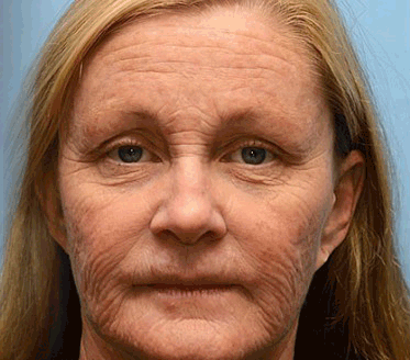 🎁 🎁Zostało tylko 5 sztuk! Oferujemy dodatkową zniżkę 50%! Zdobądź formę i zdrowie. Nie czekaj, stracisz okazję, aż do przyszłego roku