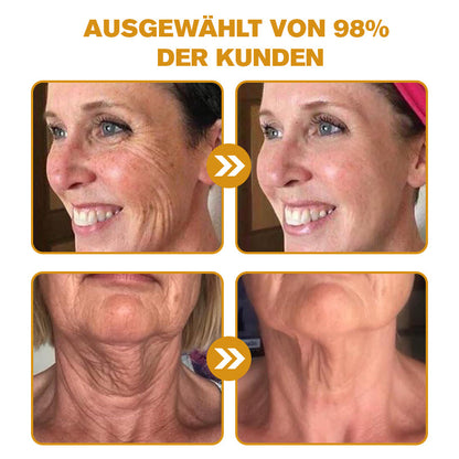 Hergestellt in Deutschland ✨APKAPK® Bienengift Hautregenerations creme – Anti-Aging, Feuchtigkeitsspendend, Hautreparatur, Hautbildverbesserung, Akne- und Pigmentfleckenbehandlung, Warzen- und Muttermalentfernung, Linderung bei Psoriasis